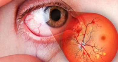 LA EPIDEMIA INVISIBLE: la diabetes que roba la visión
